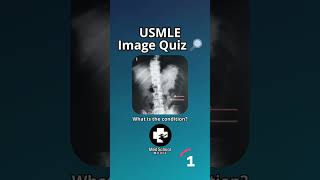 ⬆️More high yield USMLE here | 📌Answer in comments #usmle #usmlestep1 #medstudent #medschool #shorts