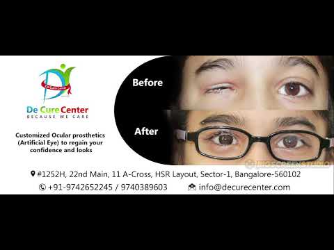 Customised Artificial Eye