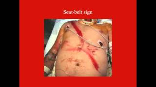 Abdominal Trauma - CRASH! Medical Review Series