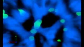 injured liver showing white blood cells within blood vessels