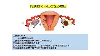 子宮内膜症と不妊