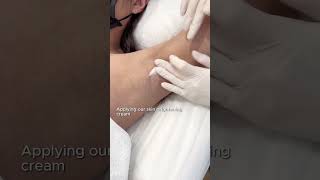 輕鬆減淡腋下的黑色素！安全無痛的美白療程