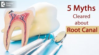 5 Myths Cleared about Root Canal | Common RCT Doubts Cleared-Dr. Shahul Kamal Asif | Doctors' Circle