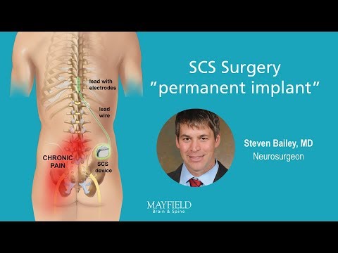 HF10 Spinal Cord Stimulation: Part 2 Surgery