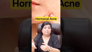 Hormonal Acne Diet #foodforacne #acne #skincare #shorts #dadumedicalcentre