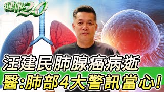 汪建民肺腺癌病逝 醫:肺腺癌易轉移！ 肺部4大警訊當心！健康2.0 @tvbshealth20