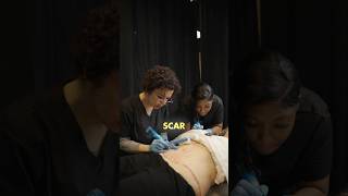 Unlock Scar Camouflage Secrets: Live Seminar Revealed! 💉