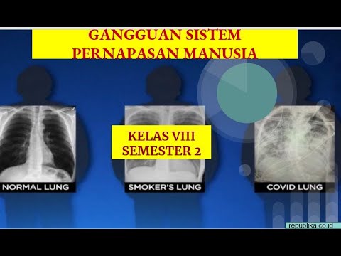 GANGGUAN SISTEM PERNAPASAN