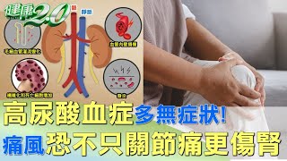 高尿酸血症多無症狀! 痛風恐不只關節痛更傷腎 健康2.0 @tvbshealth20​