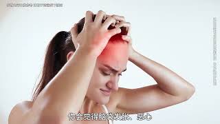 每一次偏头痛都是你大脑神经内的一场大战！ #科普#慢性偏头痛管理  #科普一下 #涨知识
