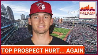 Chase Delauter to see a hand specialist; can the Guardians ever count on him to be healthy?