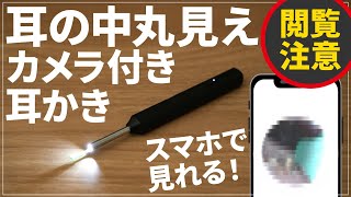 [Viewer discretion advised] Recommended ear pick with camera for cleaning your ears | Recommended...