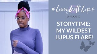 Living with Lupus: My Wildest Lupus Flare