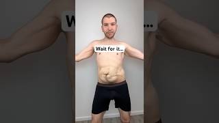 Skin Removal Reveal — 10 Million Views 😳