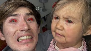 ジェームズの子どもの目が見えなくなりました。