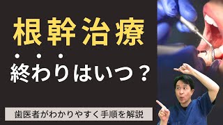 【根管治療②】歯医者が分かりやすく手順を解説