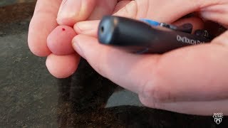 Mayo Clinic Minute: Does your child have diabetes? Symptoms to watch for