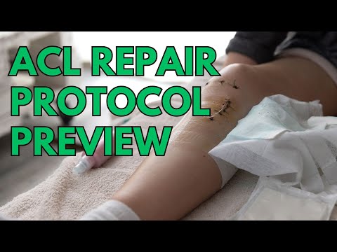 Complete ACL Injury Recovery | Expert Insights | Step-by-Step Repair Protocol
