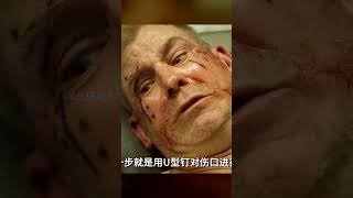 非醫生男人想當大夫，結果手術失敗！患者慘了！ #愛情 #喜劇 #網絡大電影 #自制電影 #懸疑