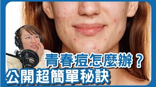 逆轉青春痘變好的秘密，居然那麼簡單？！你我皆能做到！