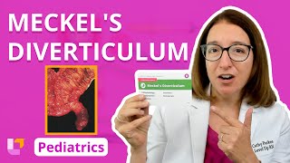 Meckel's Diverticulum: Alterations in Health - Gastrointestinal Pediatrics | @LevelUpRN