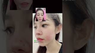 Baby cheek face filler unlimited