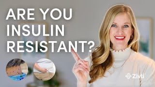 15 Insulin Resistance Signs and Symptoms You NEED To Know