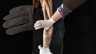 Dissected Popliteal Fossa - By Dr. Nisha Shah