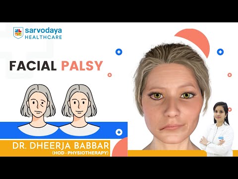 Neuromuscular Reeducation in Facial Palsy | By Dr Dheerja Babbar physiotherapist |Sarvodaya Hospital