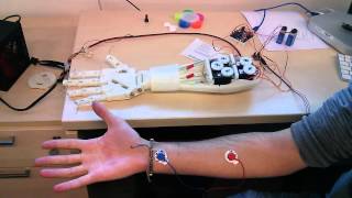 Roujin Project - InMoov Arm  and EMG 1