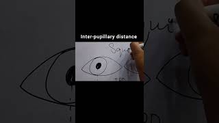 🔍 How to Measure IPD in Squint Patients! 🎯 #optometry #optometrystudent  #optometry #ipd #shorts