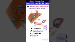 Urine in human | urine in body | human urine | Danerous of urine  #neet #shorts #biology #upsc #bio