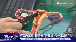 女性癌症第10名! 許家蓓「子宮內膜癌」病逝｜TVBS新聞 @TVBSNEWS01