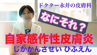 【ドクター永井の皮膚科】なにそれ？自家感作性皮膚炎