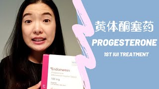 Endometrin 黄体酮塞药是怎样的体验❓Progesterone tablets for Luteal Phase Support 💊 1st Round IUI Treatment