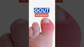 The #1 Vitamin That Fights Gout Naturally #gout #vitamin