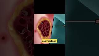Asmr Treatment #asmr #brainasmr #cleandrandruff