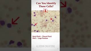 Can you identify these Cells In Body Fluid ? 🧐🙄🤔 #Quiz 380