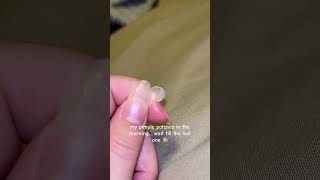 Like how does it get all that… #pimplepatch #acne #acneskin #skincare #pimples