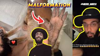 HMI MOWGLI A UN PROBLEME AU PIED