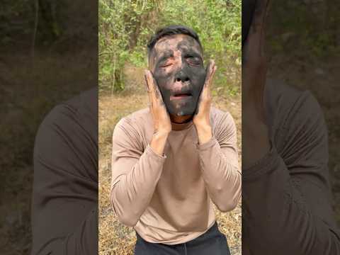 Survival Skincare: Clearing Acne with Charcoal in the Wild