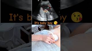 Ultrasound showing boy baby !!!🤰