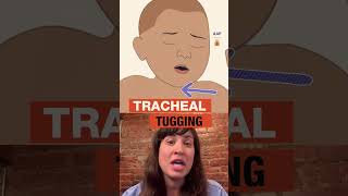 URGENT: Recognize RSV Warning Signs for Babies | AAP #shorts
