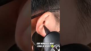 Clean your ears safely & Easily! The Best Ear Wax Remover Device