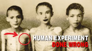 Unimaginable Horrors: Most Gruesome Experiments on Twins