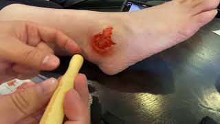 “Infected Ulcer” prosthetic makeup application
