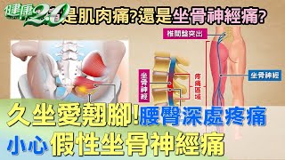 久坐愛翹腳！腰臀深處疼痛 小心假性坐骨神經痛 健康2.0