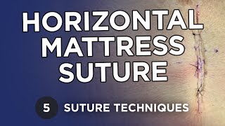 Horizontal Mattress, Figure of 8, Half Buried Sutures - Learn Suture Techniques