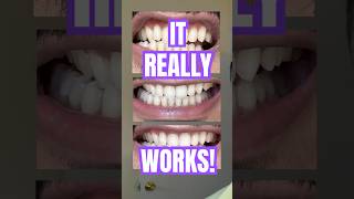🪄✨#viraltoothpaste #niacinamide #yecuce #skincare #haircare #teethcare #haul #sneakpeak whiteteeth