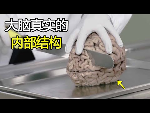 大脑的内部结构是怎么样的？将大脑切成7等份，你就明白了！